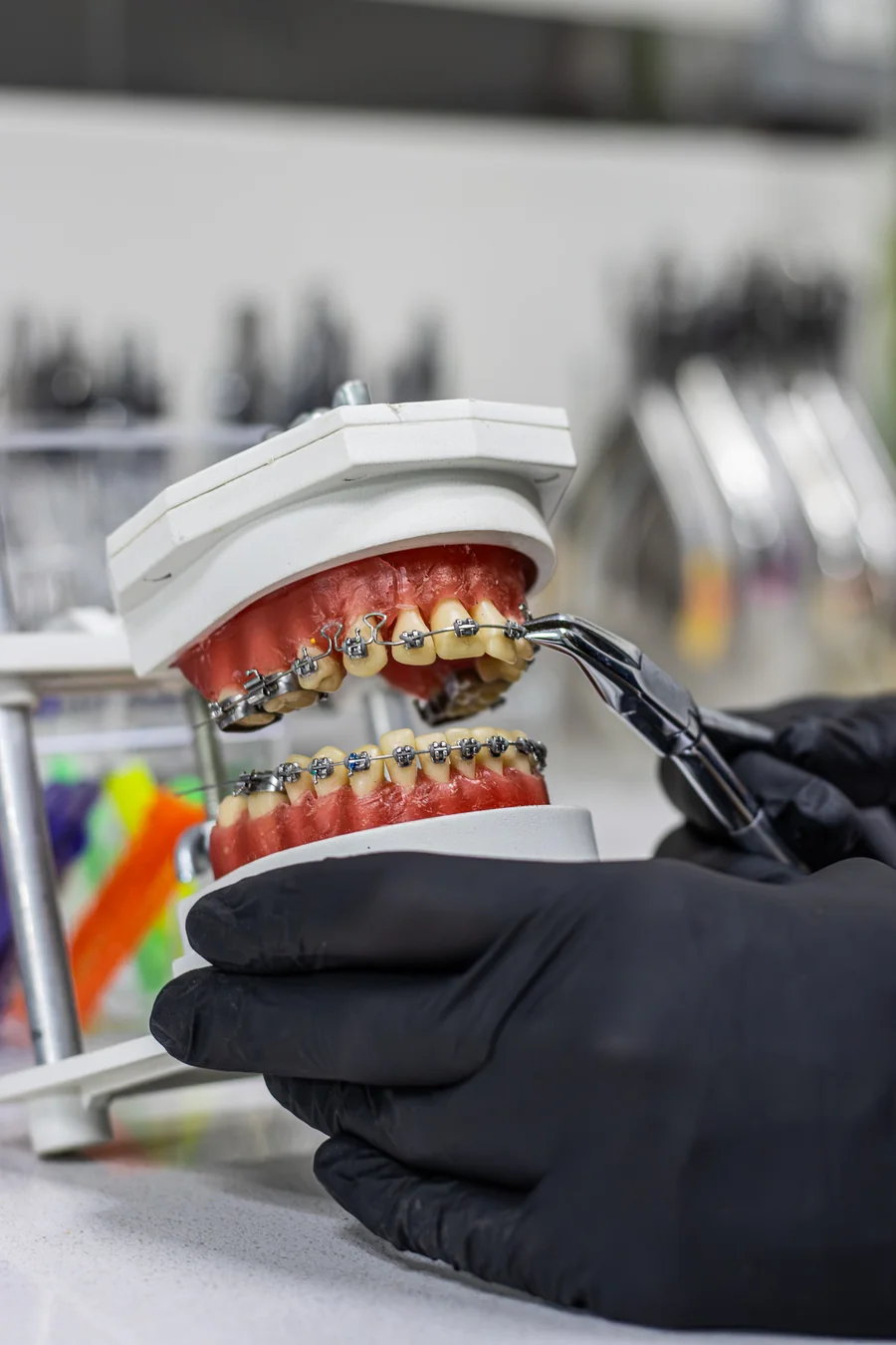Modelo de estudio con brackets durante un control de ortodoncia